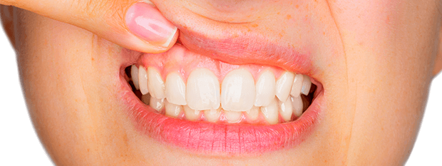 Don't Forget Your Lips This Summer